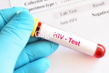 නොමිලේ එච්.අයි.වී. පරීක්ෂාවක්.