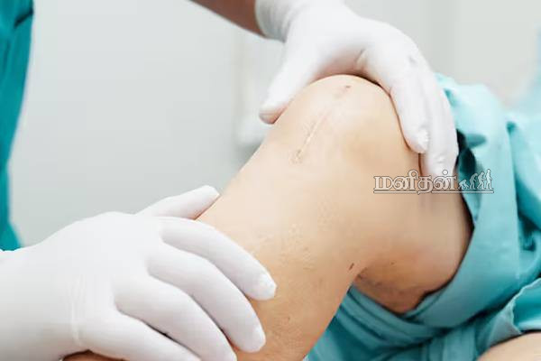 முழங்கால் அறுவை சிகிச்சைக்குப் பின் தாய் மொழியையே மறந்த சிறுவன்! என்ன நடந்தது? | After Knee Surgery A 17 Year Old Teenager Behaver