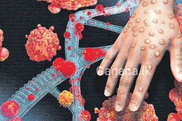 මන්කිෆොක්ස් ගැන ලෝක සෞඛ්‍ය සංවිධානයෙන් විශේෂ දැනුම්දීමක්..