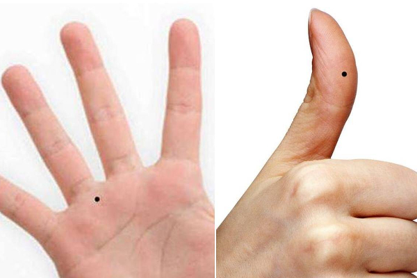 உடம்புல இந்த இடத்துல மச்சம் இருக்கா? யாருக்கும் கிடைக்காத அதிர்ஷ்டம் உங்ககிட்ட இருக்கும்! | Mole Astrology Moles Unravel Your Destiny