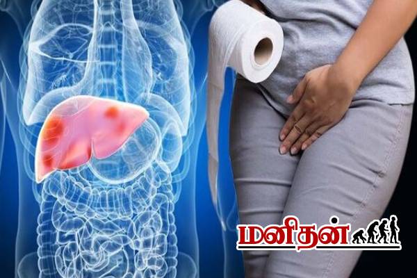 இந்த பழக்கம் இல்லாடியும் கல்லீரல் பாதிப்பு வருமாம்.. அறிகுறிகளை தெரிஞ்சிக்கோங்க | Early Signs Of Liver Disease இந்த பழக்கம் இல்லாடியும் கல்லீரல் பாதிப்பு வருமாம்.. அறிகுறிகளை தெரிஞ்சிக்கோங்க | Early Signs Of Liver Disease