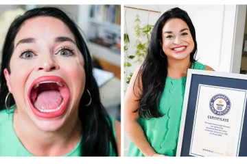 அடேங்கப்பா.. உலகிலேயே மிகப்பெரிய வாய் - பிரபலமான இளம்பெண்!