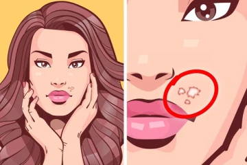 නියපොතු සැපීමේ පුරුද්ද නිසා ඇති විය හැකි අහිතකර සෞඛ්‍ය ගැටළු.