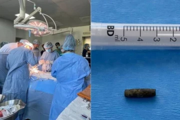 உக்ரைன் வீரரின் இதயத்தில் பாய்ந்த குண்டை அகற்றும் மருத்துவர்கள்: அவர் சொன்ன வார்த்தைகள்