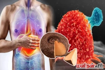 பித்தம் முதல் புற்றுநோய் வரை தீர்வு கொடுக்கும் கருணை கிழங்கு வறுவல்! இப்படி செய்து பாருங்க