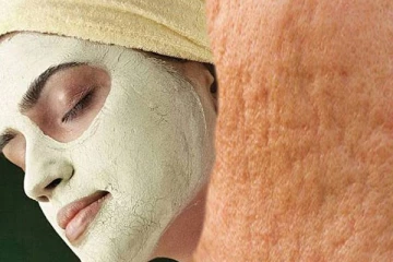 முகத்தில் அதிகமா குன்றும் குழியா இருக்கா; அப்போ இதை செய்திடுங்கள்!