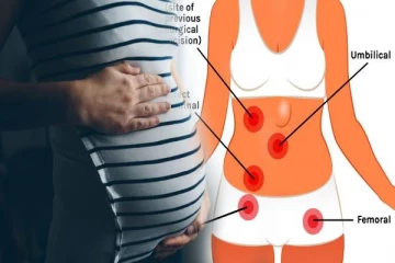 அடிக்கடி வெளியில் வந்து மானத்தை வாங்கும் தொப்பை எப்படி குறைக்கலாம் தெரியுமா?