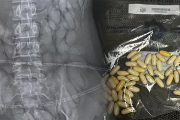 விமான நிலையத்தில் இளம்பெண்ணை சோதனையிட்ட பொலிசார்: எக்ஸ்ரேயில் தெரிந்த காட்சி