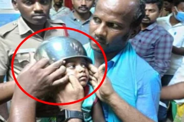விபரீதமான விளையாட்டு; பானைக்குள் மாட்டிக்கொண்ட சிறுவனின் தலை!