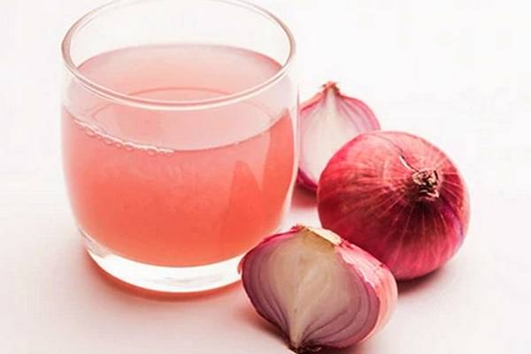 வெங்காய சாறு பயன்படுத்தினால் வழுக்கை தலையிலும் முடி வளருமா? | Using Onion Juice Help Hair Grow On A Bald Head வெங்காய சாறு பயன்படுத்தினால் வழுக்கை தலையிலும் முடி வளருமா? | Using Onion Juice Help Hair Grow On A Bald Head