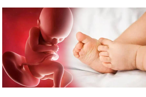 பீகாரில் பிறந்து 40 நாட்களே ஆன பச்சிளங் குழந்தையின் வயிற்றில் கரு - அதிர்ச்சி அடைந்த டாக்டர்கள் - தமிழ்நாடு