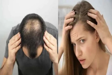 முடி உதிர்வால் கவலைப்படுகின்றீர்களா...இலகுவில் விடுபட இதனை மட்டும் செய்யுங்கள்