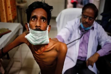 வவுனியாவில் காசநோயாளர்கள் தொடர்பில் வெளியான தகவல்!