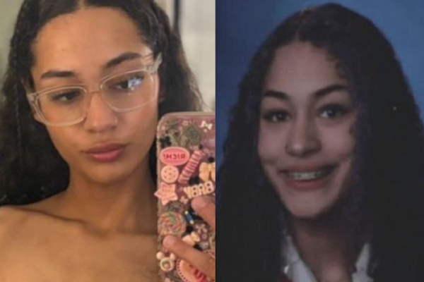 அமெரிக்காவில் pit bull நாய்கள் தாக்கி 23 வயது பெண் உயிரிழப்பு | 23 Year Old Woman Killed By Pit Bulls Dogs In Us