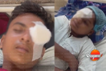 දරුවෝ 14 කට ඇස් පෙනීම අහිමි වෙයි - මාරාන්තික හේතුව මෙන්න