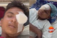 දරුවෝ 14 කට ඇස් පෙනීම අහිමි වෙයි - මාරාන්තික හේතුව මෙන්න