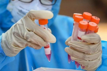 தொடர்ந்தும் ஆபத்தில் யாழ் மாவட்டம்;  மேலும் 62 பேருக்கு கொரோனா