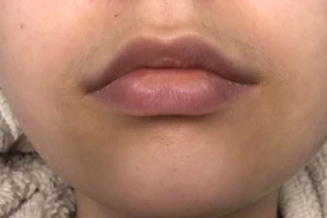 வாயை சுத்தி அசிங்கமா கருப்பா இருக்கா? பத்தே நிமிடத்தில் போக்க இந்த ஒரே ஒரு பொருள் போதும்!