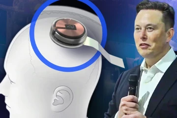 எலன் மஸ்கின் புதிய கன்டுபிடிப்பு; மனித மூளைக்குள் சிப்பா