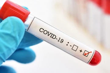 வடக்கில் மேலும் 25 பேருக்கு கோவிட் தொற்று - மருத்துவர் கேதீஸ்வரன் தகவல்