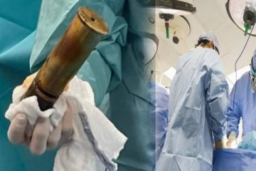 வெடிகுண்டை பின்புறத்தில் சொருகிய முதியவர்! அதிர்ச்சியடைந்த மருத்துவர்கள்