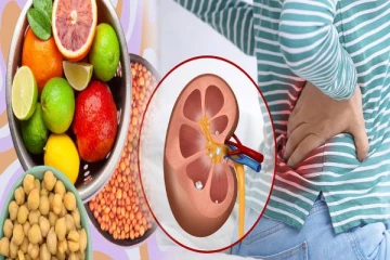 Kidney Stone: சிறுநீரகத்தில் கல் இருக்கா? மறந்தும் கூட இந்த 5 உணவுகளை சாப்பிடாதீங்க