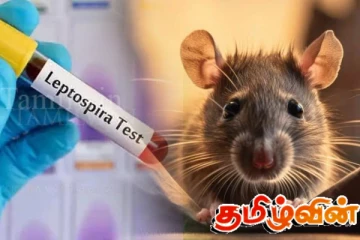 வவுனியாவில் இதுவரை 41 பேருக்கு எலிக்காய்ச்சல்
