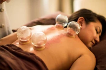 ஒட்டுமொத்த உடல் பிரச்சினைகளுக்கும் தீர்வு கொடுக்கும் கப்பிங் தெரபி பற்றி தெரியுமா?