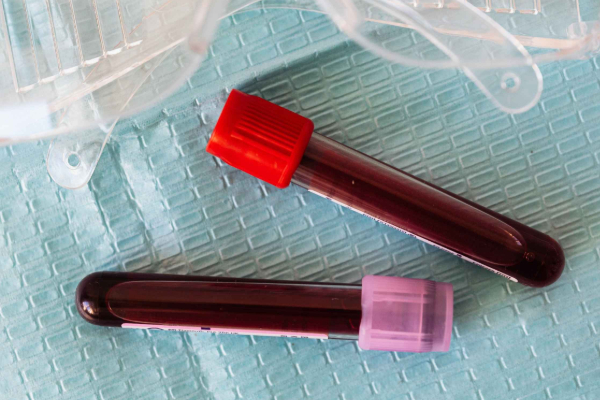 கருச்சிதைவு ஏற்பட்ட பெண்ணின் உடலில் ஆண் குரோமோசோம்கள்: வியப்பில் மருத்துவர்கள் | Male Chromosomes In Woman Blood After Miscarriage கருச்சிதைவு ஏற்பட்ட பெண்ணின் உடலில் ஆண் குரோமோசோம்கள்: வியப்பில் மருத்துவர்கள் | Male Chromosomes In Woman Blood After Miscarriage