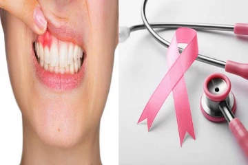 மக்களே அவதானம் ; அதிகரித்து வரும் வாய் புற்றுநோய் பாதிப்பு