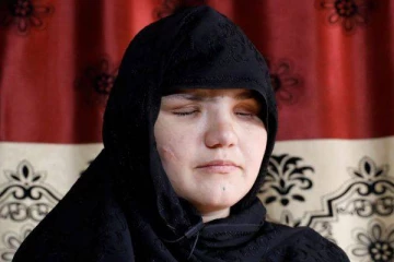 பெண்களின் உடலை நாய்களுக்கு உணவாகும் தலிபான்கள்...பாதிக்கப்பட்ட பெண் வெளியிட்ட தகவல்