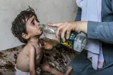 ஊட்டச்சத்து குறைபாட்டால் உயிர் ஊசலாடும் காசா குழந்தைகள் : ஐநா அபாய அறிவிப்பு