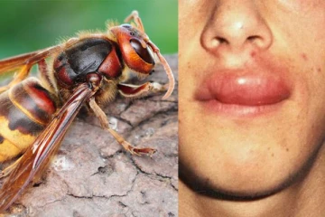 குளவி கொட்டி விட்டால் மறந்தும்கூட இந்த தவறை செய்யாதீங்க! ஆபத்தானது