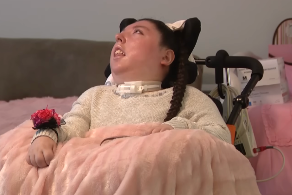 මොළයේ 90%ක් නැති තරුණියක් 20 වැනි උපන්දිනය සමරයි | Young Woman Missing 90 Of Brain Turns 20