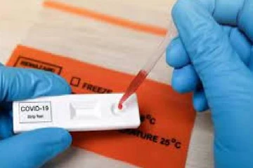 எழுமாறான கோவிட் பரிசோதனைகளை அதிகரிக்குமாறு சுகாதார தரப்பினர் கோரிக்கை