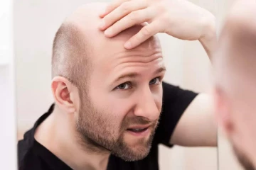 வழுக்கையில கூட முடி வளர வேண்டுமா? வாரத்தில் இரண்டு முறை இதனை பயன்படுத்தினாலே போதுமாம்