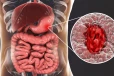 Stomach Ulcer: வயிற்று புண்கள் ஏற்படுவதற்கு முக்கியமான காரணம்