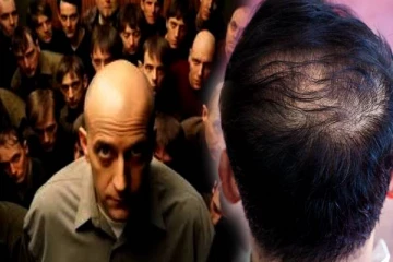 சின்ன வயசுலேயே வழுக்கை வந்திருச்சா? அப்போ இந்த பதிவு உங்களுக்காக..