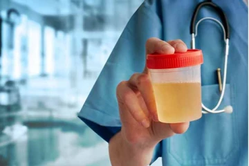 சிறுநீரின் நிறம் மாறுபடுகின்றதா? அலட்சியம் வேண்டாம் உடனே மருத்துவரை பாருங்க