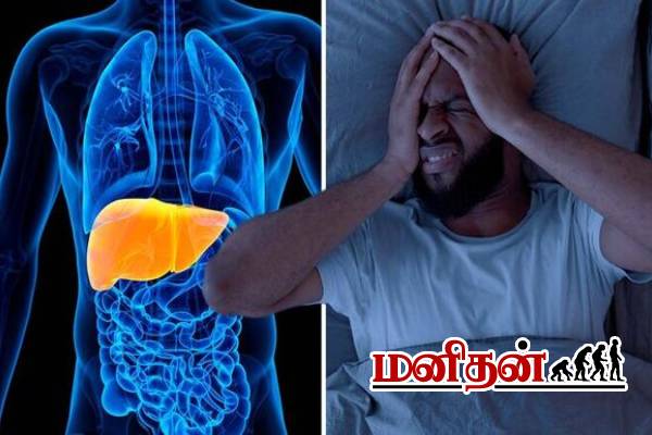 இந்த பழக்கம் இல்லாடியும் கல்லீரல் பாதிப்பு வருமாம்.. அறிகுறிகளை தெரிஞ்சிக்கோங்க | Early Signs Of Liver Disease இந்த பழக்கம் இல்லாடியும் கல்லீரல் பாதிப்பு வருமாம்.. அறிகுறிகளை தெரிஞ்சிக்கோங்க | Early Signs Of Liver Disease