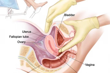 பெண்களின் பிறப்புறுப்பை குறி வைத்து தாக்கும் ஆபத்தான புற்றுநோய்! எந்த வயதில் வரும் தெரியுமா?