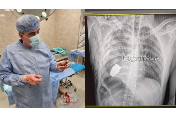 ukraine-doctors-successfully-surgery-vog-grenade