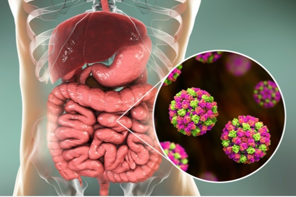 இங்கிலாந்தில் அதி தீவிரமாக பரவும் ”நோரோ வைரஸ்”! வெளியான அதிர்ச்சியூட்டும் தகவல் | England Nora Virus Spread