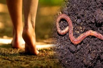 உள்ளங்காலை பதம் பார்த்த புழுக்கள்.. காலணி அணியாதவர்கள் தெரிஞ்சிக்கோங்க