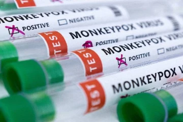 குரங்கு அம்மை பாதித்த இளைஞர் திடீர் மரணம் : கேரளாவில் பரபரப்பு