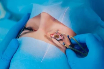 பெண்ணின் கண்களில் இருந்து உயிருடன் மீட்கபட்ட 60 புழுக்கள்! அதிர்ச்சி சம்பவம்