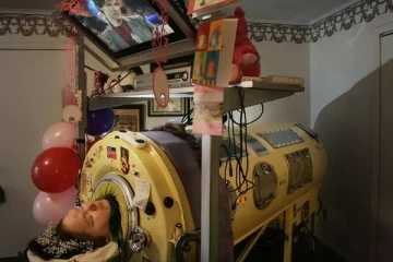 60 ஆண்டுகளாக உலோக நுரையீரல் உதவியுடன் வாழ்ந்துவந்த பெண்: மின் தடையால் உயிரிழந்த சோகக் கதை