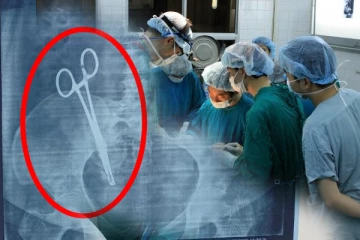 பெண் வயிற்றுக்குள் கத்தரிக்கோல்; 17 வருடங்களுக்கு பின் தெரிந்த உண்மை!