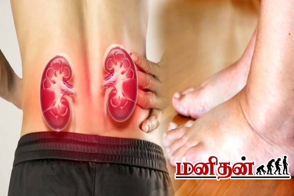 இந்த இடத்துல வலி வந்தால் உடனே சோதனை பண்ணுங்க- சிறுநீரகம் ஆபத்து வாய்ப்பு அதிகம்! | Kidney Damage Symptoms Pain In The Body