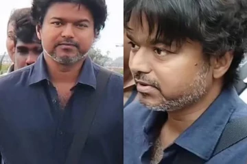 வீங்கி உப்பிப்போன தளபதி விஜய்யின் முகம்!! உண்மையான காரணமே இதுதானாம்..